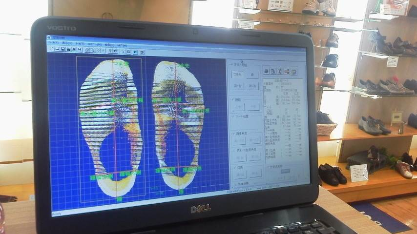 足の計測機で足もとから健康をサポート